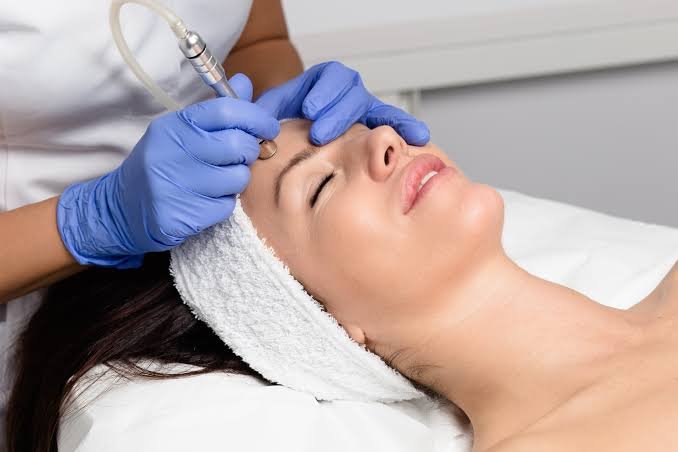 Microdermabrasion Treatment